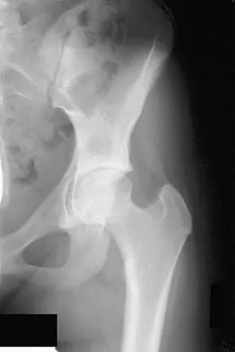 General Orthopedics Board Review 2026: High-Yield MCQs (Set 18) - Figure 102