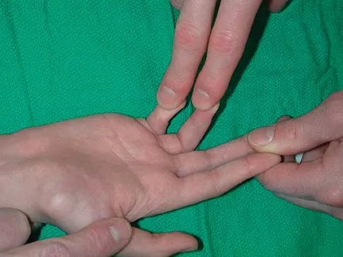 General Orthopedics Board Review 2026: High-Yield MCQs (Set 18) - Figure 104