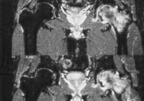 General Orthopedics Board Review 2026: High-Yield MCQs (Set 18) - Figure 105