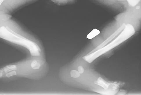 General Orthopedics Board Review 2026: High-Yield MCQs (Set 18) - Figure 109