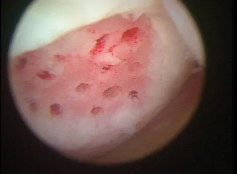 General Orthopedics Board Review 2026: High-Yield MCQs (Set 18) - Figure 122