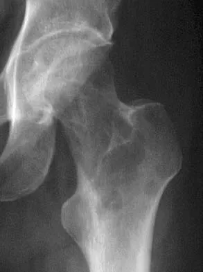 General Orthopedics Board Review 2026: High-Yield MCQs (Set 18) - Figure 123