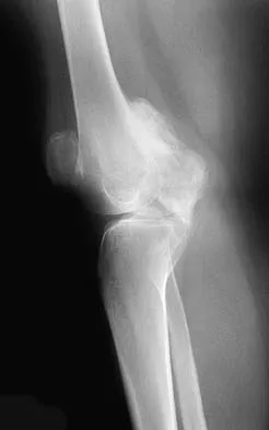 General Orthopedics Board Review 2026: High-Yield MCQs (Set 18) - Figure 130