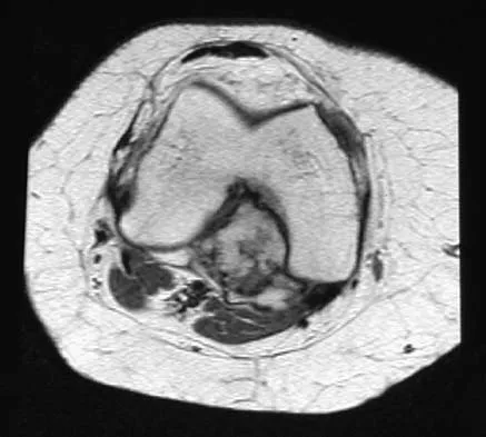 General Orthopedics Board Review 2026: High-Yield MCQs (Set 18) - Figure 132