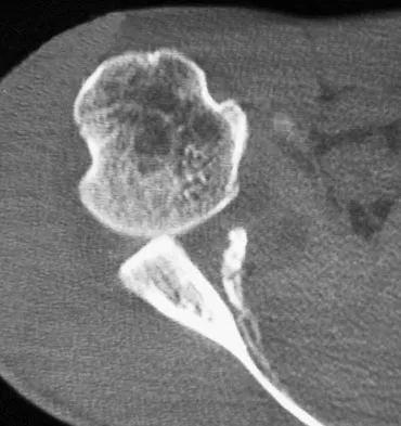 General Orthopedics Board Review 2026: High-Yield MCQs (Set 18) - Figure 14