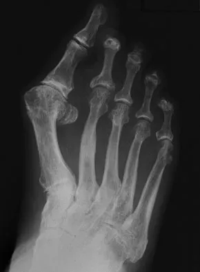 General Orthopedics Board Review 2026: High-Yield MCQs (Set 18) - Figure 17