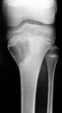 General Orthopedics Board Review 2026: High-Yield MCQs (Set 18) - Figure 19