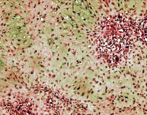 General Orthopedics Board Review 2026: High-Yield MCQs (Set 18) - Figure 22