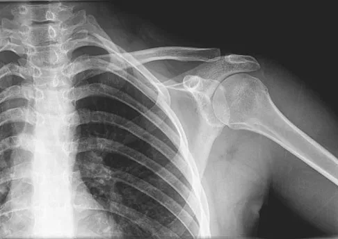 General Orthopedics Board Review 2026: High-Yield MCQs (Set 18) - Figure 25