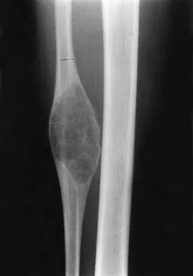 General Orthopedics Board Review 2026: High-Yield MCQs (Set 18) - Figure 29