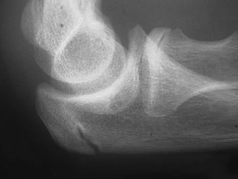 General Orthopedics Board Review 2026: High-Yield MCQs (Set 18) - Figure 3