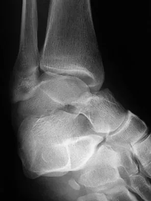 General Orthopedics Board Review 2026: High-Yield MCQs (Set 18) - Figure 33