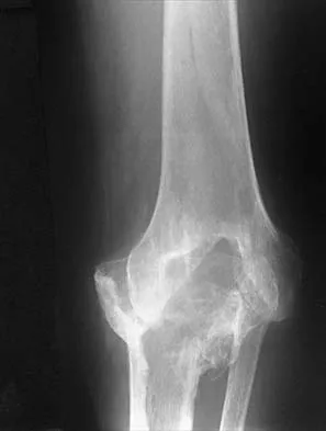 General Orthopedics Board Review 2026: High-Yield MCQs (Set 18) - Figure 35