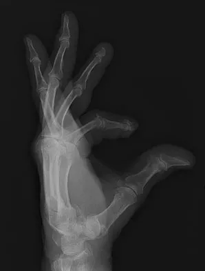 General Orthopedics Board Review 2026: High-Yield MCQs (Set 18) - Figure 45