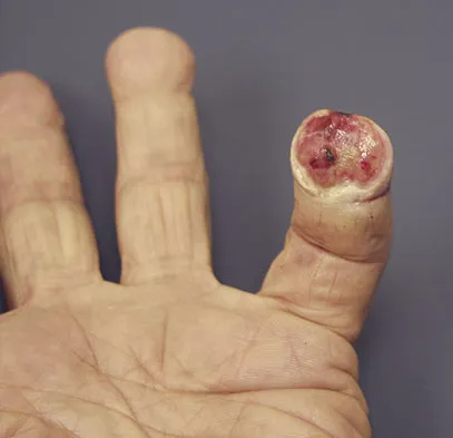 General Orthopedics Board Review 2026: High-Yield MCQs (Set 18) - Figure 46