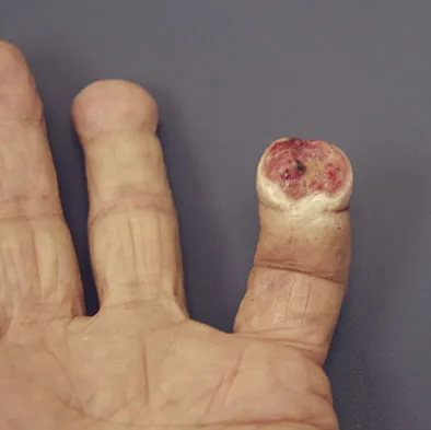 General Orthopedics Board Review 2026: High-Yield MCQs (Set 18) - Figure 47