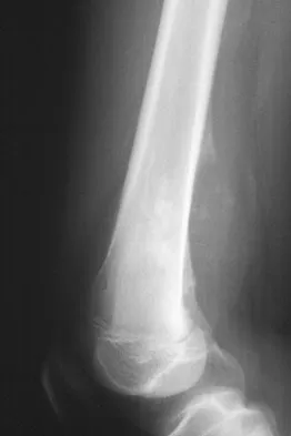 General Orthopedics Board Review 2026: High-Yield MCQs (Set 18) - Figure 56