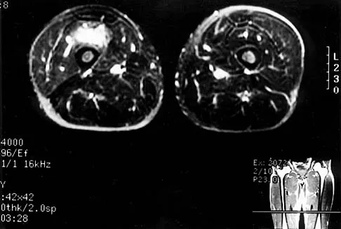 General Orthopedics Board Review 2026: High-Yield MCQs (Set 18) - Figure 63