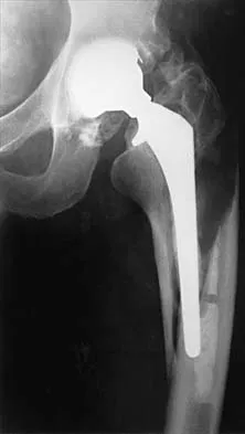 General Orthopedics Board Review 2026: High-Yield MCQs (Set 18) - Figure 66