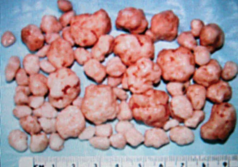 General Orthopedics Board Review 2026: High-Yield MCQs (Set 18) - Figure 69