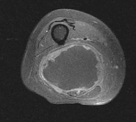 General Orthopedics Board Review 2026: High-Yield MCQs (Set 18) - Figure 7