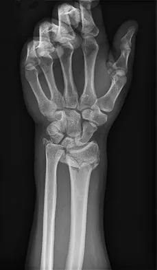 General Orthopedics Board Review 2026: High-Yield MCQs (Set 18) - Figure 72