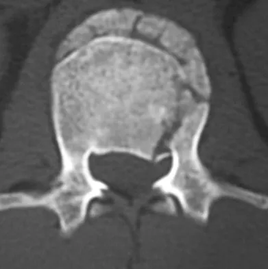 General Orthopedics Board Review 2026: High-Yield MCQs (Set 18) - Figure 81