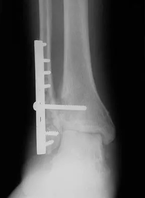 General Orthopedics Board Review 2026: High-Yield MCQs (Set 18) - Figure 86