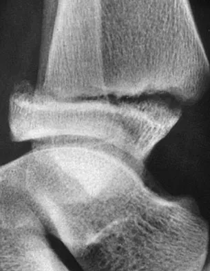 General Orthopedics 2026 Practice Questions: Set 19 (Solved) - Figure 10