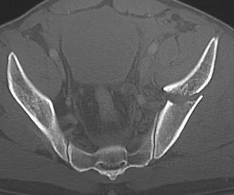 General Orthopedics 2026 Practice Questions: Set 19 (Solved) - Figure 101