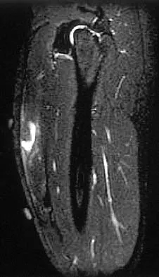 General Orthopedics 2026 Practice Questions: Set 19 (Solved) - Figure 103