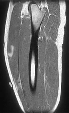General Orthopedics 2026 Practice Questions: Set 19 (Solved) - Figure 104