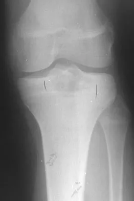 General Orthopedics 2026 Practice Questions: Set 19 (Solved) - Figure 105