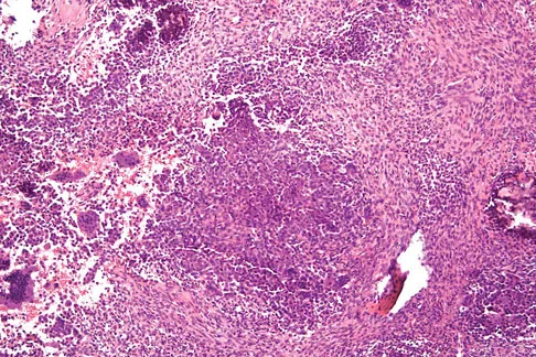 General Orthopedics 2026 Practice Questions: Set 19 (Solved) - Figure 108