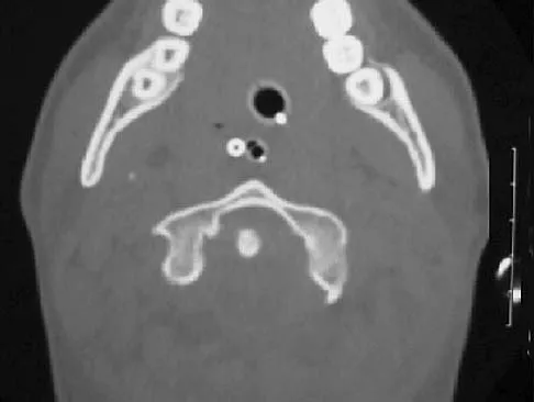 General Orthopedics 2026 Practice Questions: Set 19 (Solved) - Figure 111