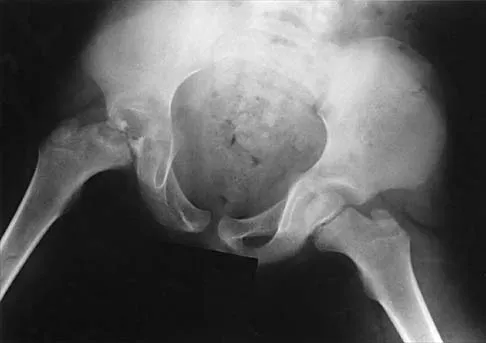 General Orthopedics 2026 Practice Questions: Set 19 (Solved) - Figure 112