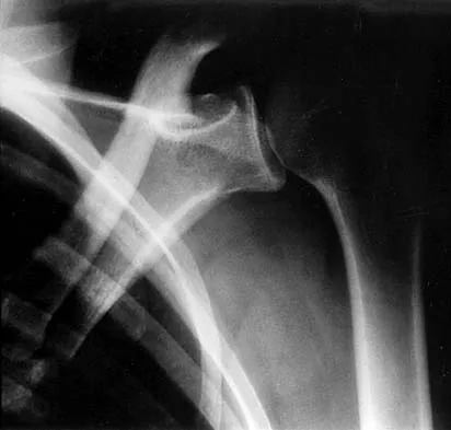 General Orthopedics 2026 Practice Questions: Set 19 (Solved) - Figure 115