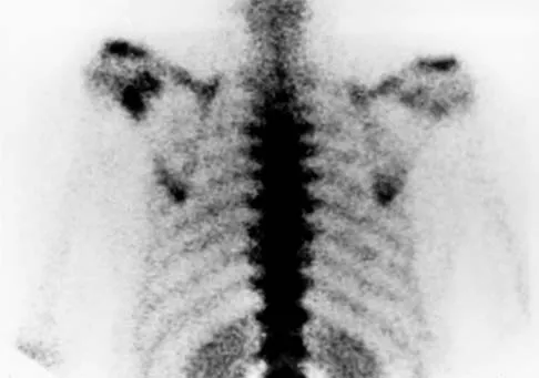 General Orthopedics 2026 Practice Questions: Set 19 (Solved) - Figure 116