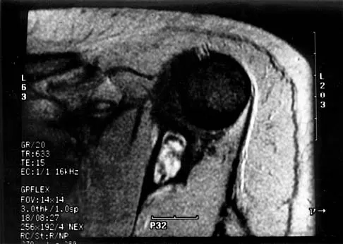 General Orthopedics 2026 Practice Questions: Set 19 (Solved) - Figure 118