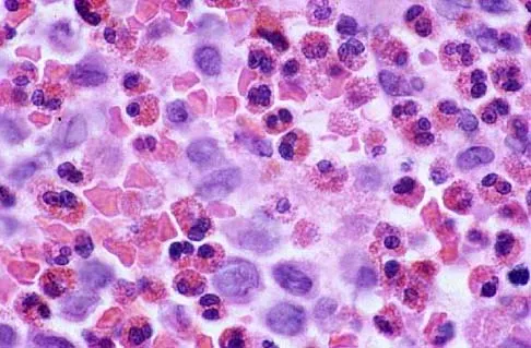 General Orthopedics 2026 Practice Questions: Set 19 (Solved) - Figure 120