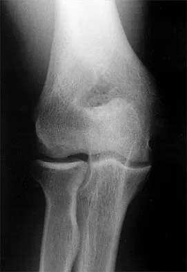General Orthopedics 2026 Practice Questions: Set 19 (Solved) - Figure 122