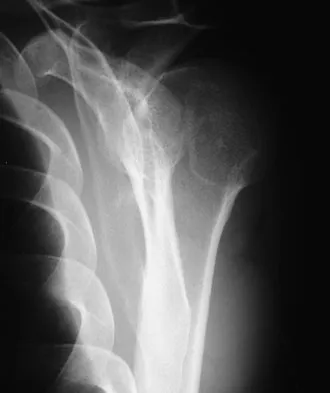 General Orthopedics 2026 Practice Questions: Set 19 (Solved) - Figure 126