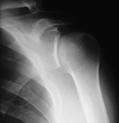 General Orthopedics 2026 Practice Questions: Set 19 (Solved) - Figure 127