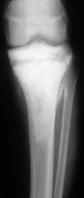 General Orthopedics 2026 Practice Questions: Set 19 (Solved) - Figure 129