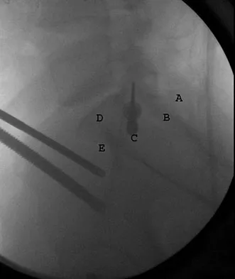 General Orthopedics 2026 Practice Questions: Set 19 (Solved) - Figure 13