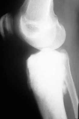 General Orthopedics 2026 Practice Questions: Set 19 (Solved) - Figure 130