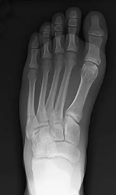 General Orthopedics 2026 Practice Questions: Set 19 (Solved) - Figure 16