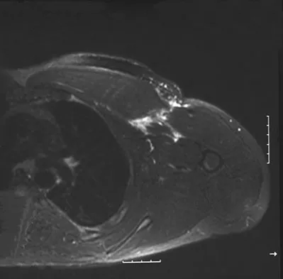 General Orthopedics 2026 Practice Questions: Set 19 (Solved) - Figure 18