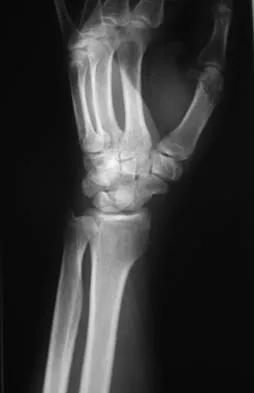 General Orthopedics 2026 Practice Questions: Set 19 (Solved) - Figure 25