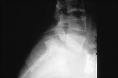 General Orthopedics 2026 Practice Questions: Set 19 (Solved) - Figure 27